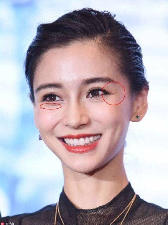 爱笑的人鱼尾纹也会早早到来75怎么改善63