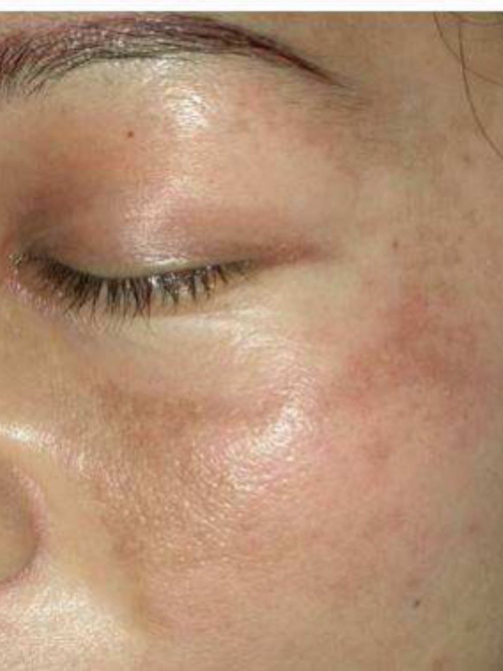 95771595有些姐妹们在怀孕的时候是不是会想出黑斑,特_圈子