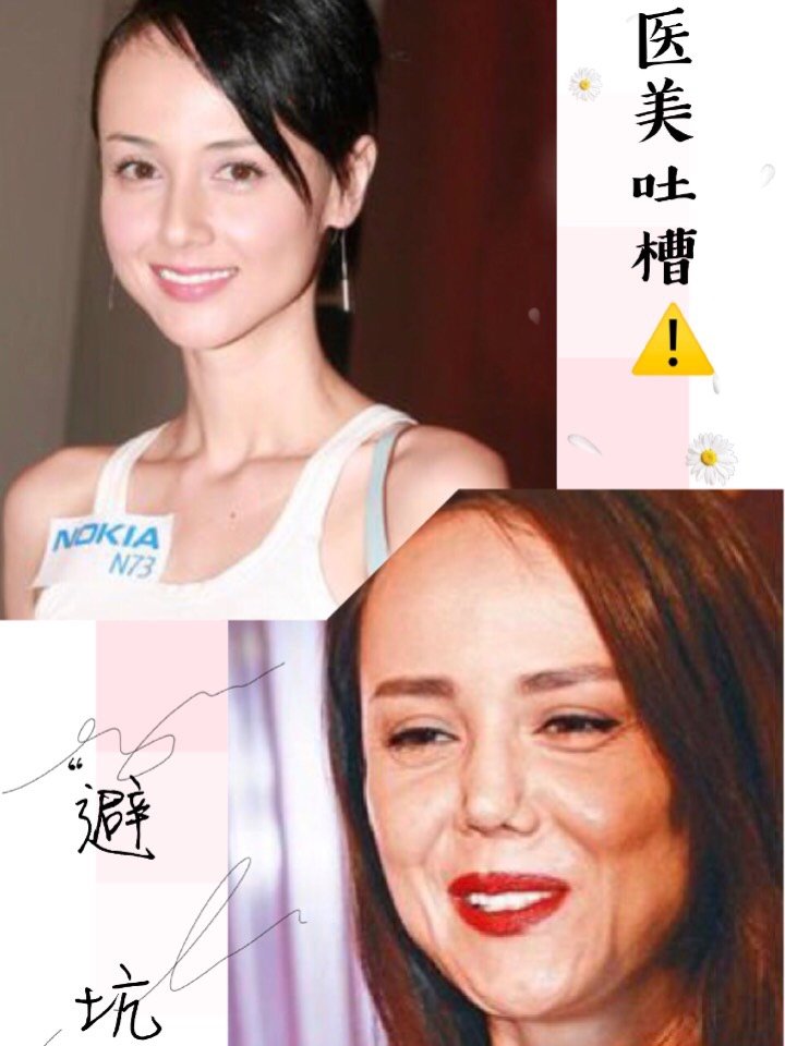 的,一不小心就会"毁容"咱们来看一下以下几位明星过度整容后果 韩君婷