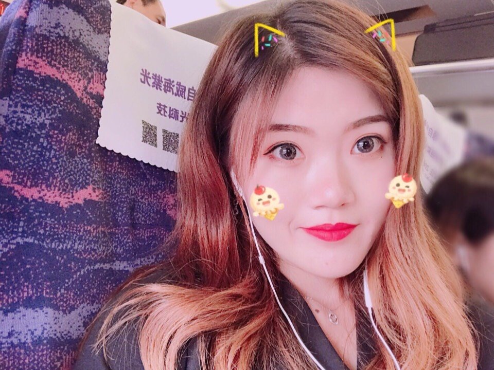 【神线医疗美容切开双眼皮术后40天】