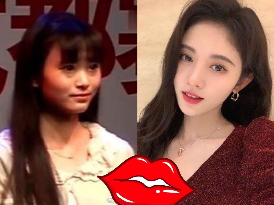 羊羊作业本# 明星网红的整容对比图