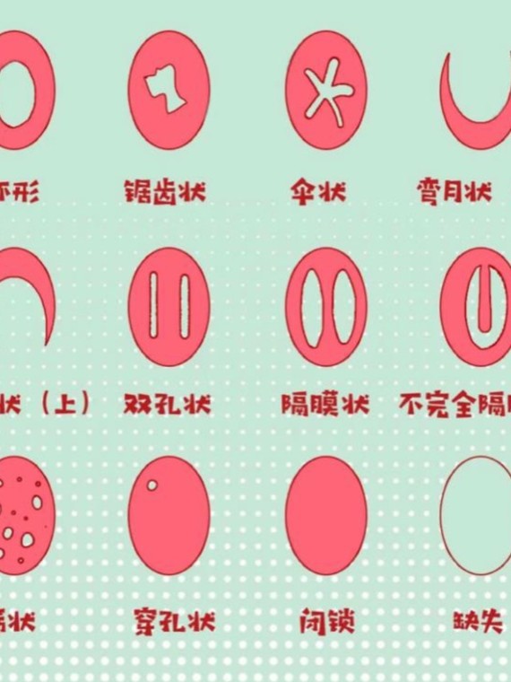 【处女膜修复案例】落红不是无情物,找回初次不是梦#_圈子-新氧美容整