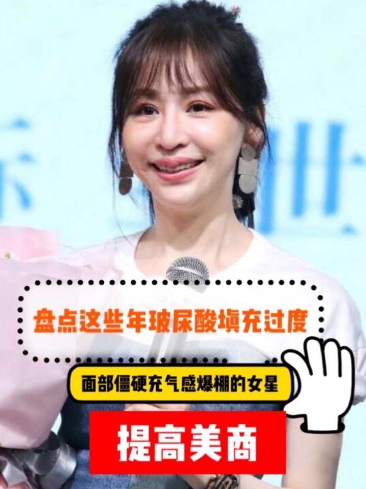 盘点玻尿酸打过量脸变僵硬的女明星