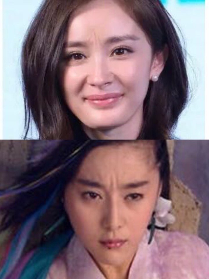 肉毒素除川字纹