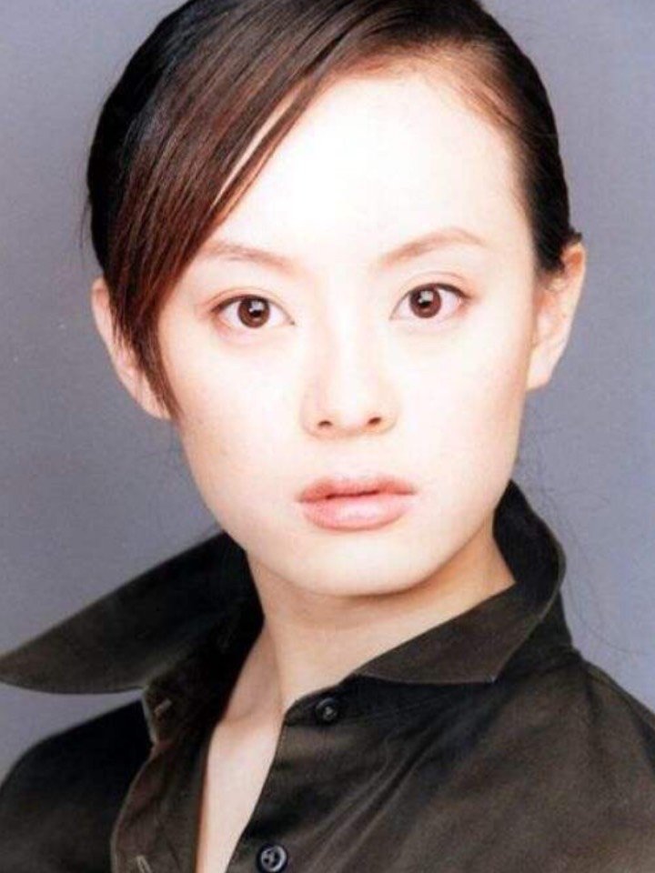 快来康康你的脱发属于哪个级别63