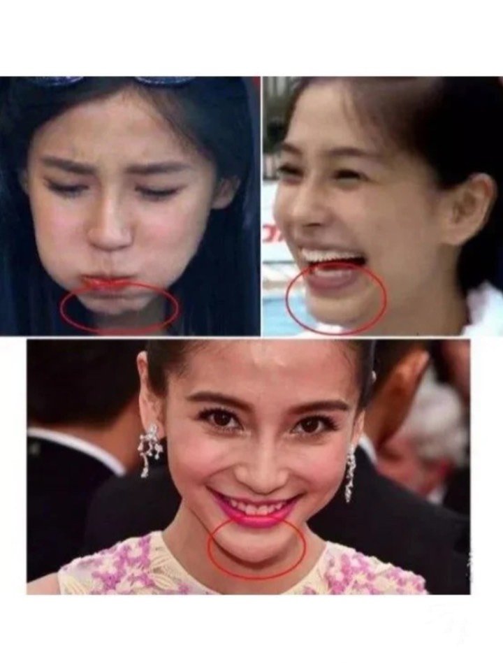 78157815早期的baby应该不到20岁,身材和现在差_圈子-新氧