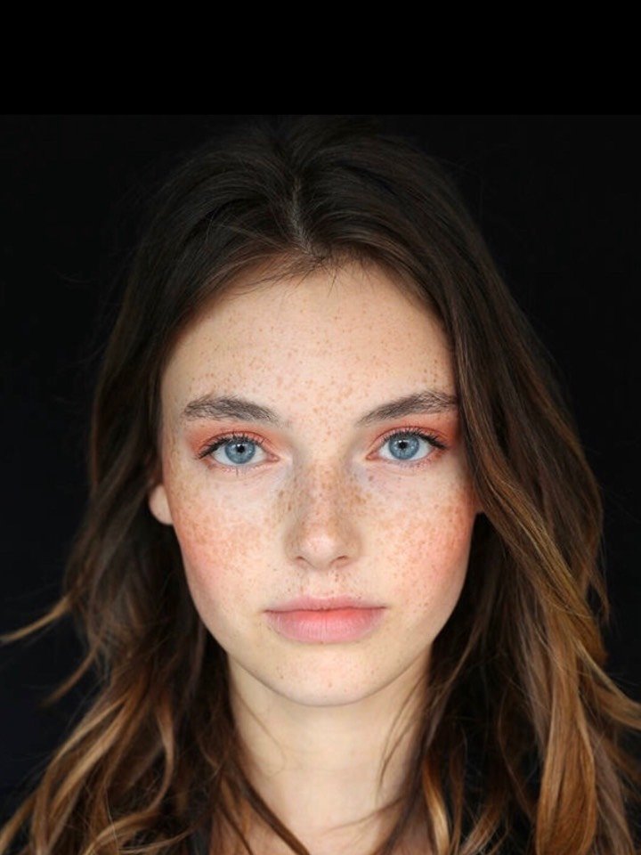 说起雀斑,很多女性既痛恨又无奈.