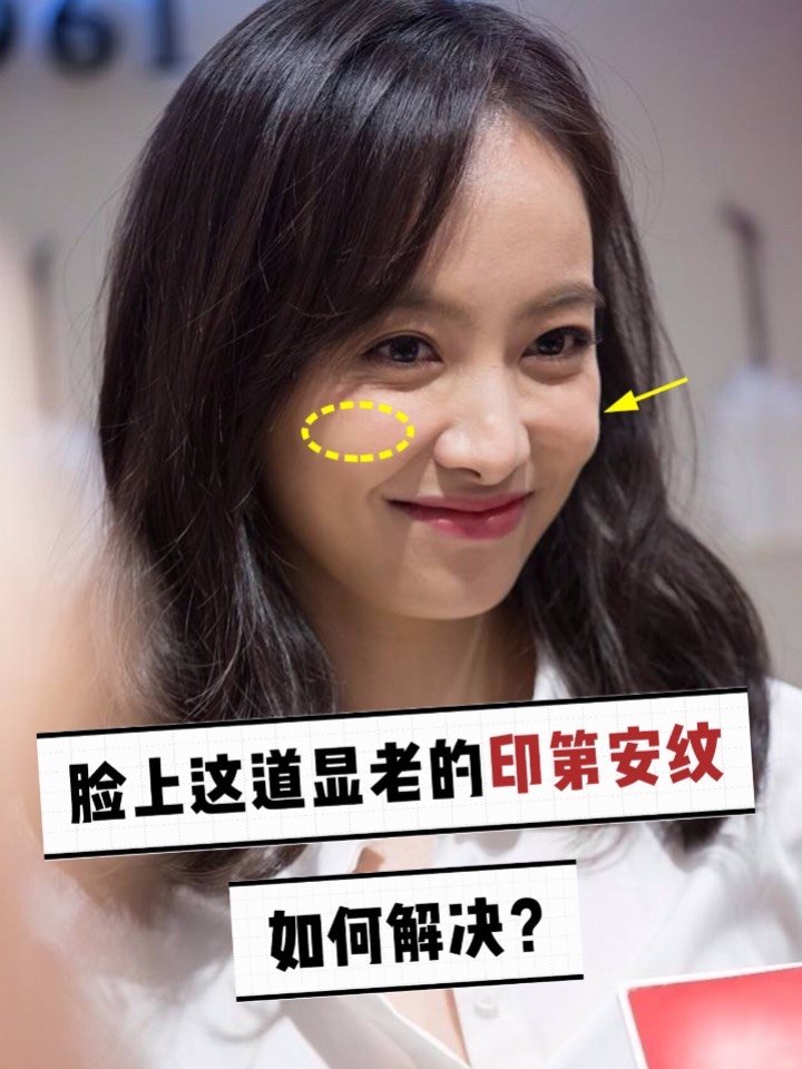印第安纹 脸上出现印第安纹,真的瞬间老10岁 因为看上去有点像印第安