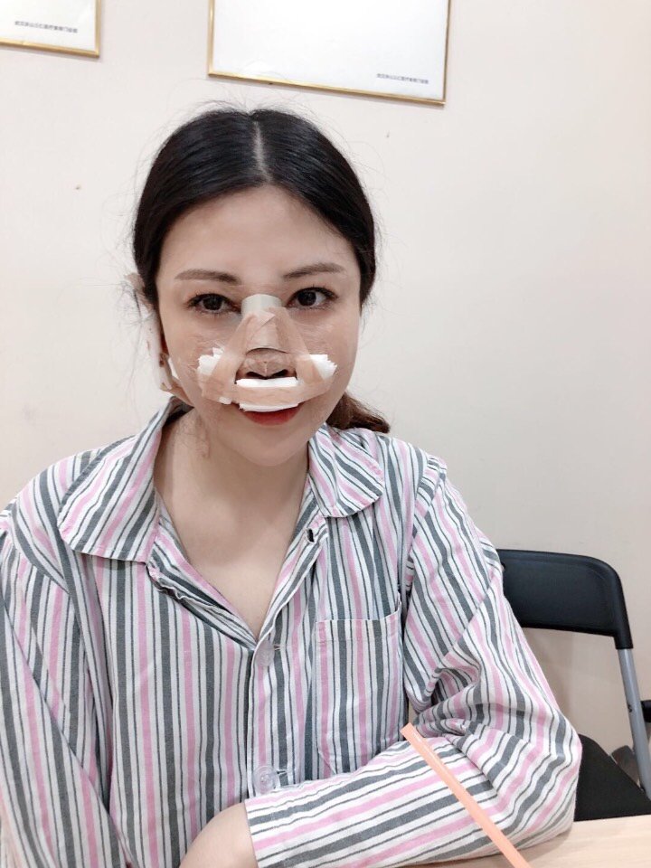 耳软骨鼻部多项 术后第一天,鼻子包扎的很严实,鼻孔_圈子-新氧美容