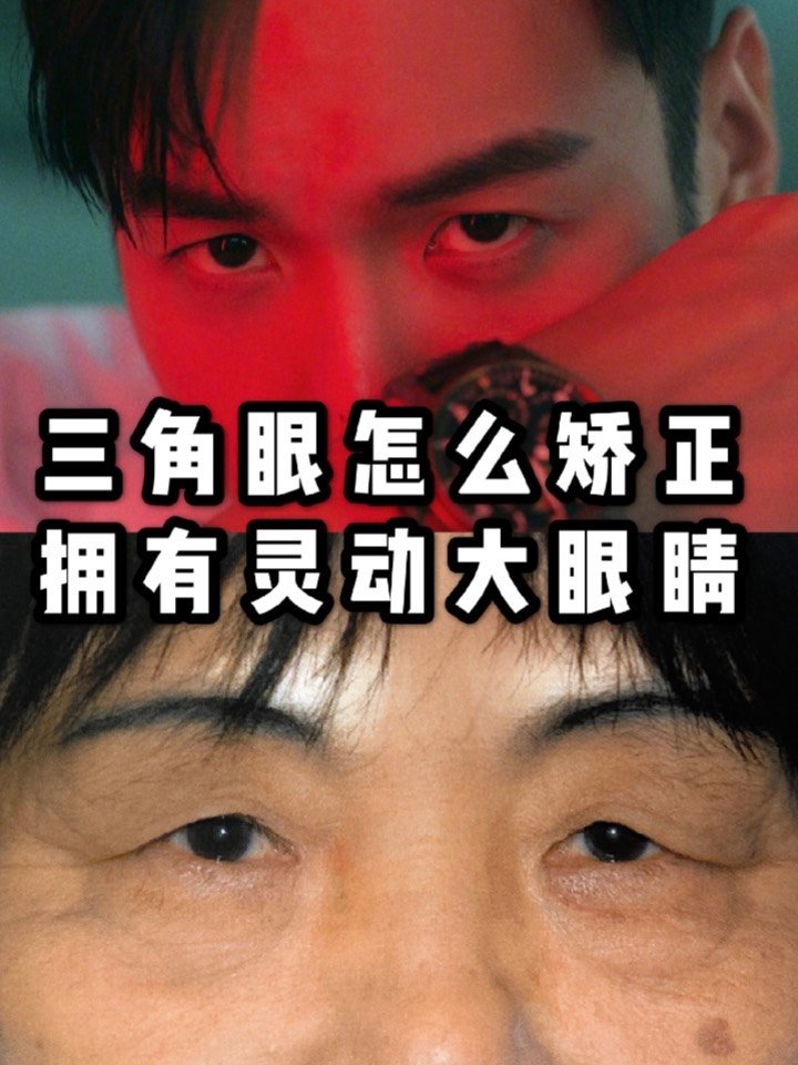 三角眼怎么矫正 拥有灵动大眼睛