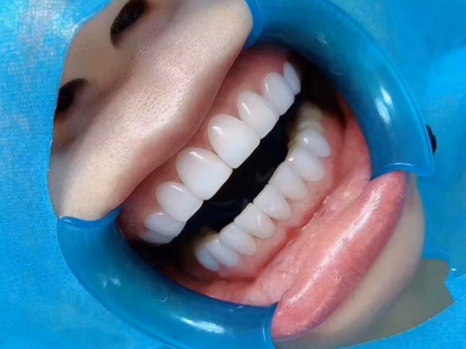 特别羡慕很多外国mm一口小白牙和自信的笑容古时形容美女的词眼也少不