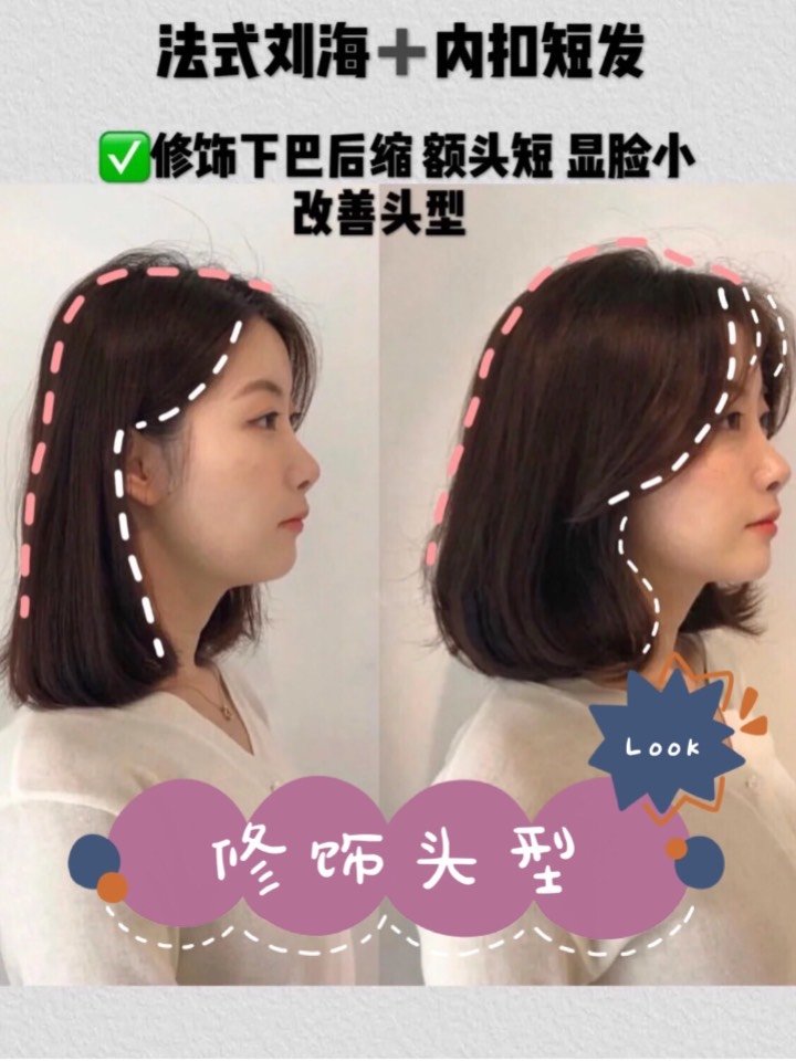 首页 此页面仅支持预览 Avatar 每天美一点呀 71篇日记 选对发型 你也能拥有绝美侧颜 嘴巴凸 下巴后缩 颧骨高 发际线高 这些问题 通通可以用发型来修饰 视觉上让你拥有绝美侧颜 图1 颅顶低 发际线高的女生 可以像图中女生这样