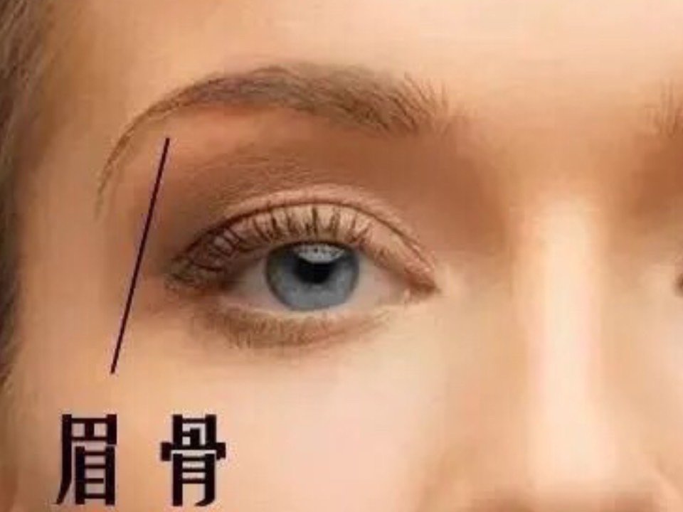 首页 此页面仅支持预览 Avatar 微微要到105 468篇日记 听说过假体眉弓么 看了彭小冉最近的剧 真是被她的换头技术所震惊 从一个稍微有点土气的女生 变成了洋气的混血脸 其中做了假体眉弓这个手术 才是她颜值发生质的变化的关键点 首先我们要清楚