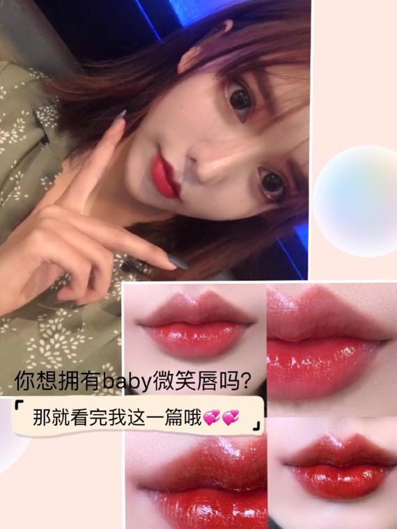 嘟嘟唇,微笑唇我觉_圈子-新氧美容整形