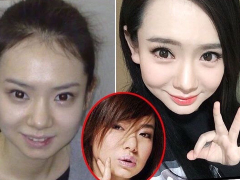 戚薇也是一个精致的大美人,却执着于割双眼皮,导致越来越宽,肉条感也