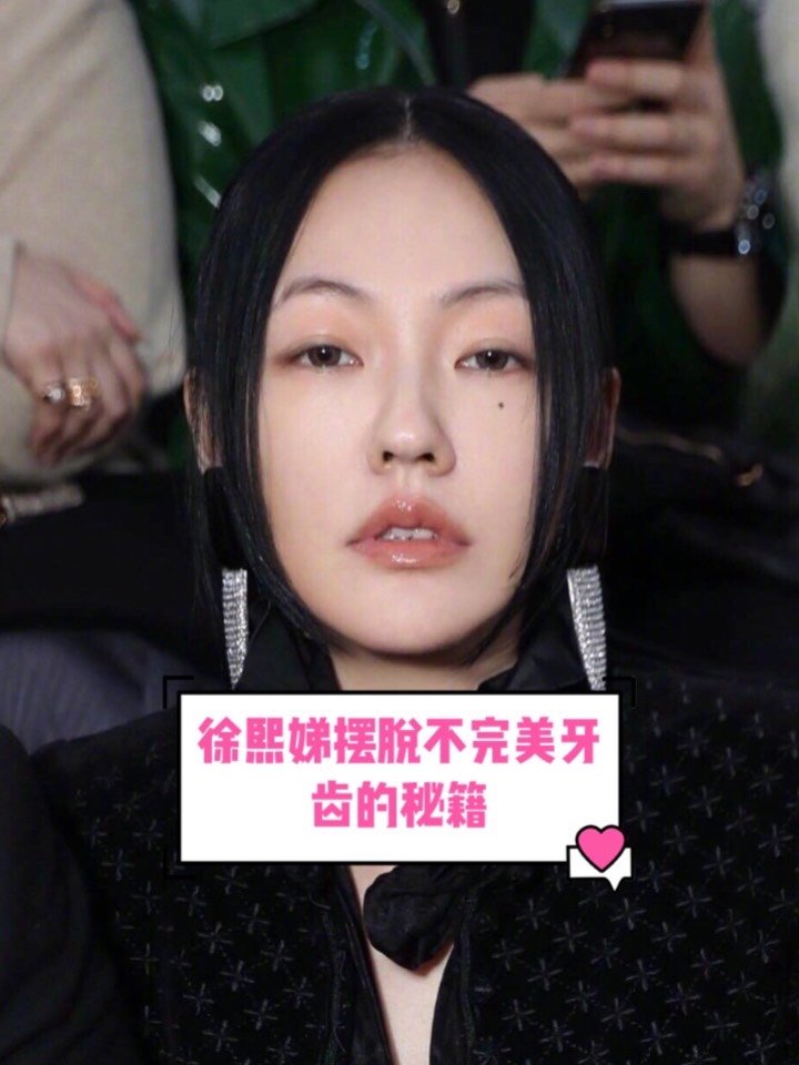 如何拯救你的牙齿小s通过戴牙套变美了许多常见的正畸方式有哪些这些