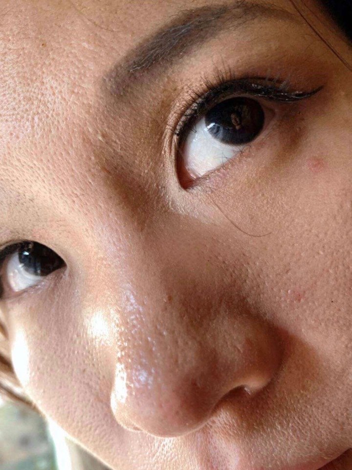 安美星河:毛孔粗大到可以插秧,化妆老卡粉的集美,可_圈子-新氧美容