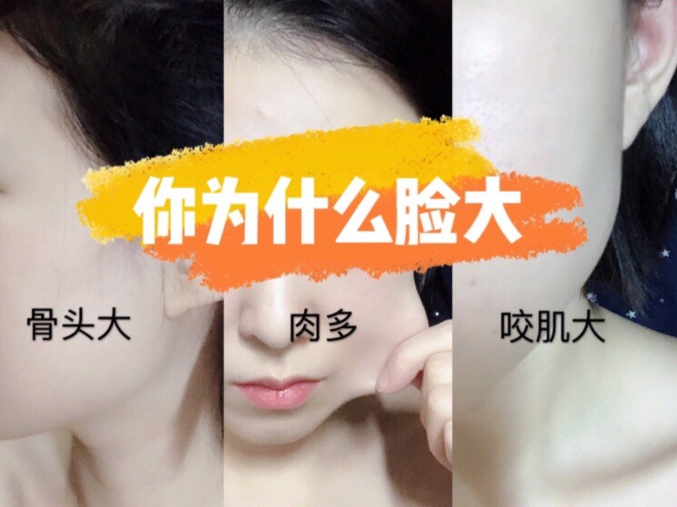 打瘦脸一般多少钱_瘦脸打多久有效果_打瘦脸多少钱一次