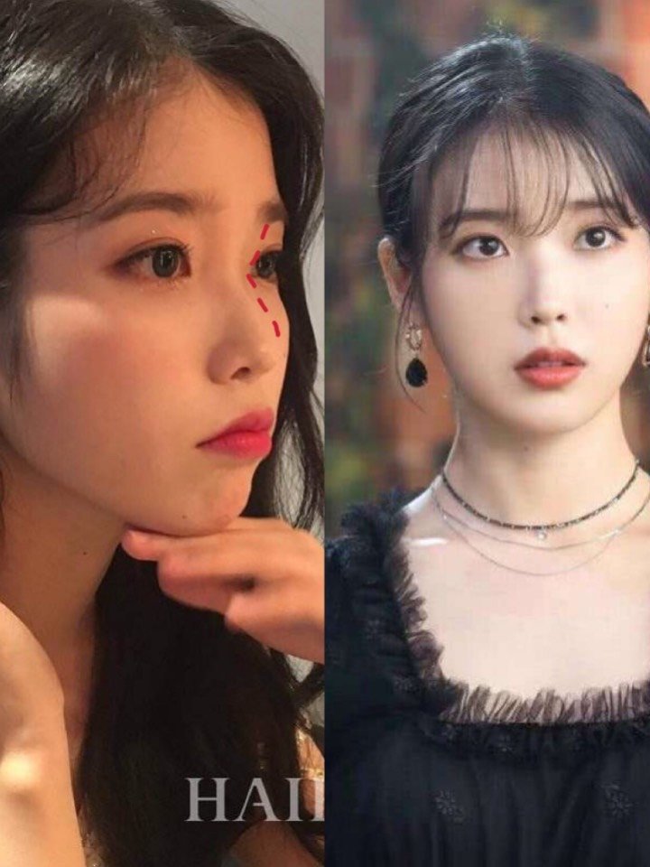 羊羊作业本 #今日新氧女孩97♀15正脸好看,侧脸02_圈子-新氧