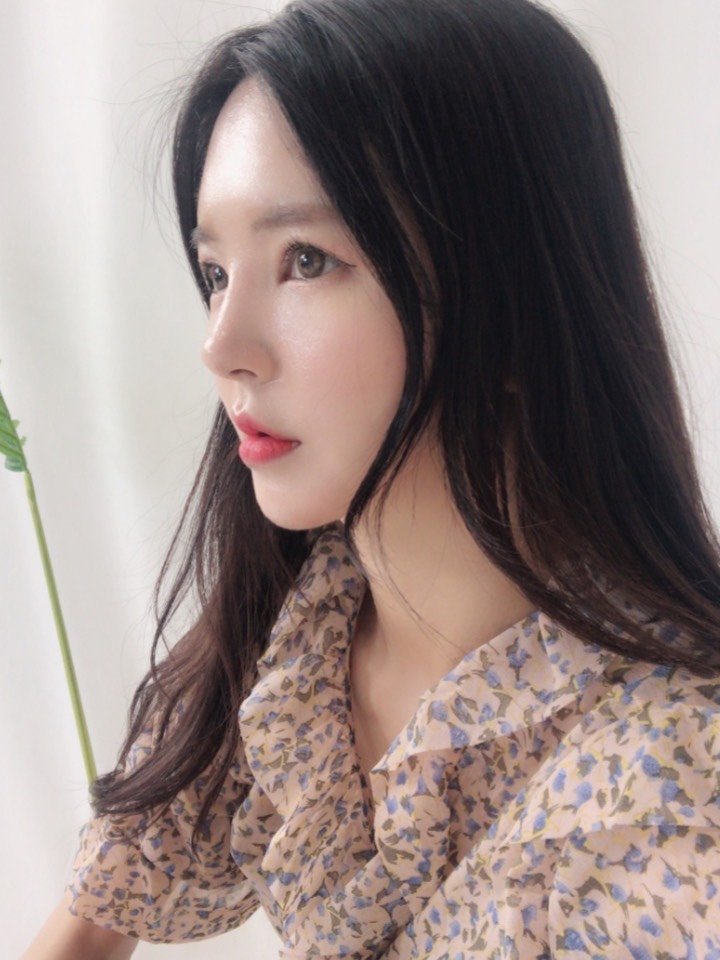 现在鼻型是又好看又自然,鼻头也软化了,手感又上升了_圈子-新氧美容