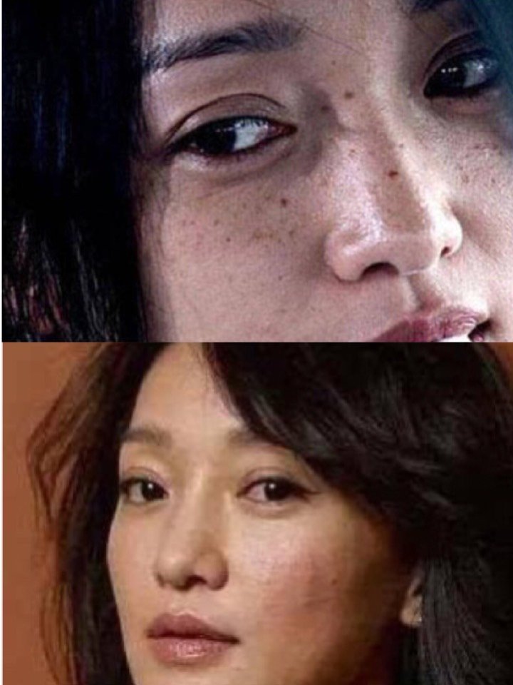 有时候脸上的雀斑还_圈子-新氧美容整形