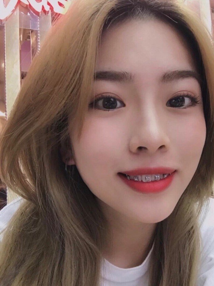 很多女孩对牙齿的保养不重视,慢慢都导致牙齿变形,出现各种牙齿问题