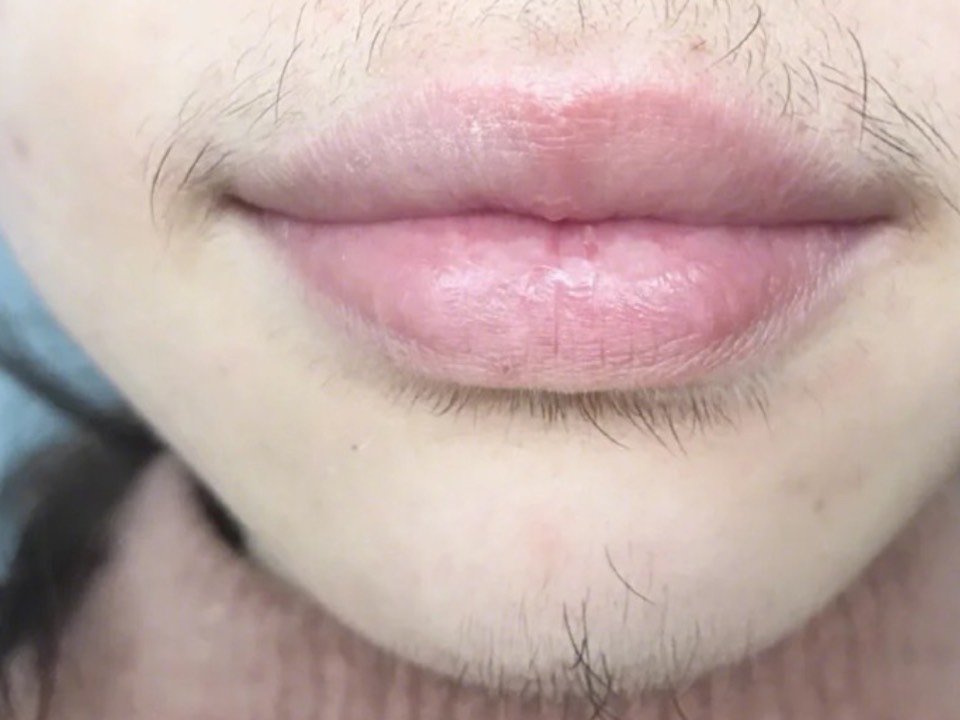 从进门开始就会有美丽的小姐姐带着你 体验脱唇毛 小_圈子-新氧美容