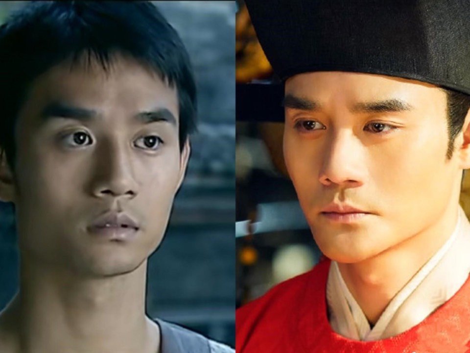 1, 硅胶垫下巴:大家术后在家休养3~4天, 4天后能取下绷带的话就可以