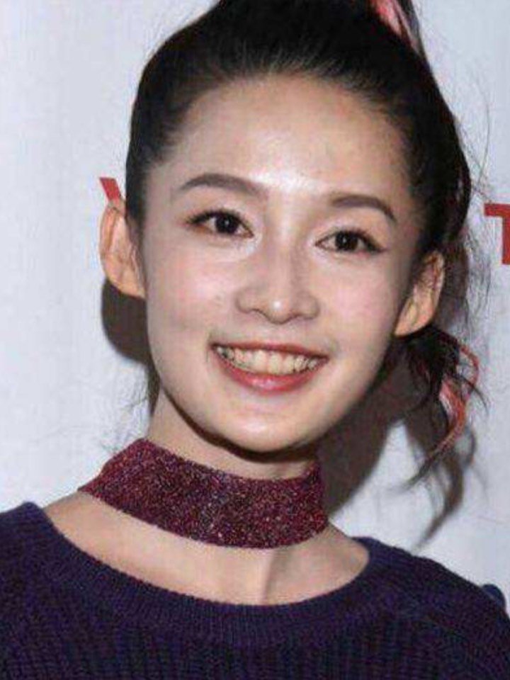 涂口红不好看,那你应该去美白 牙齿了,很多小仙女都有牙黄的困扰,整个