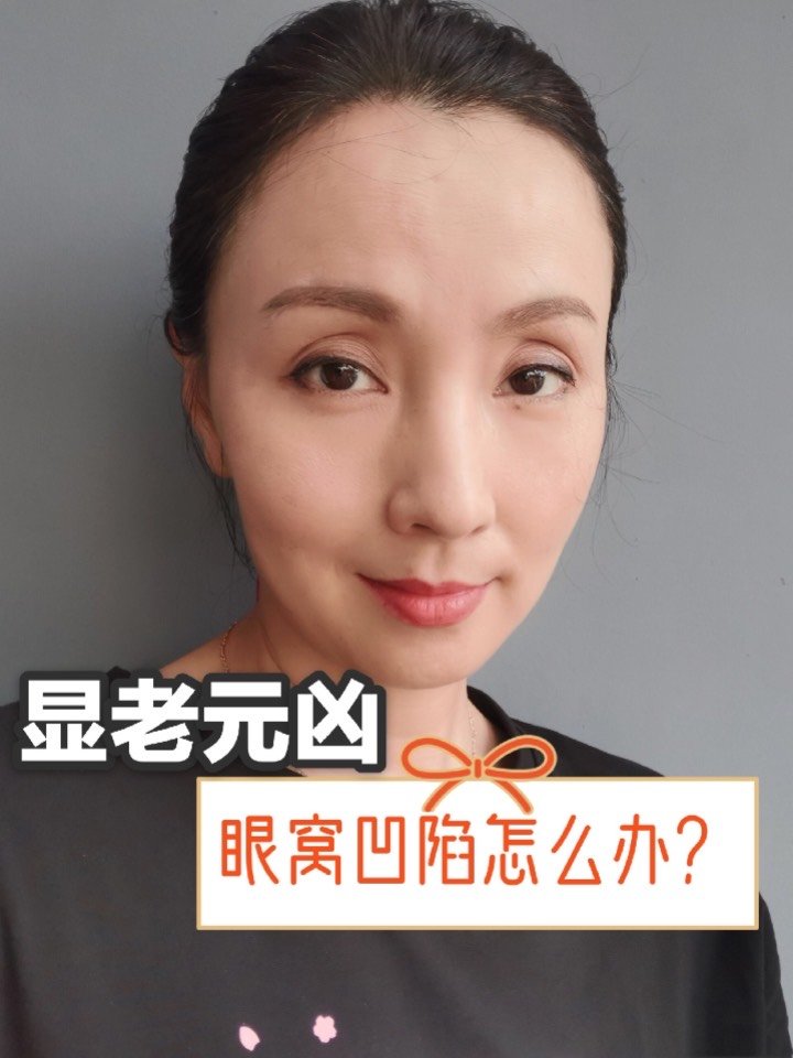 显老元凶眼窝凹陷怎么办75