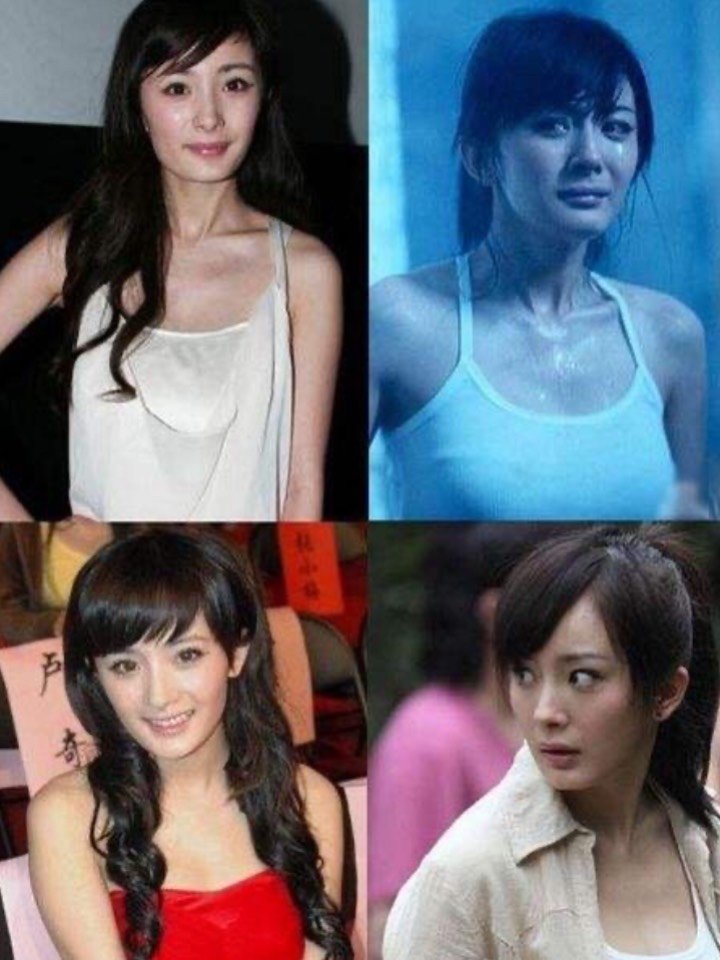 假体隆胸肯定爽,规避风险才完美