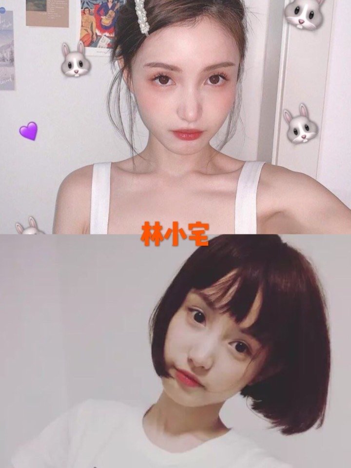 幼幼脸有哪些特征631596在快节奏中满载焦虑_圈子-新氧美容整形