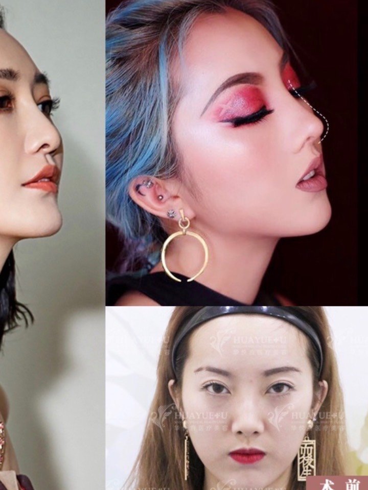 明星同款美鼻模版,你更钟爱哪一种鼻型