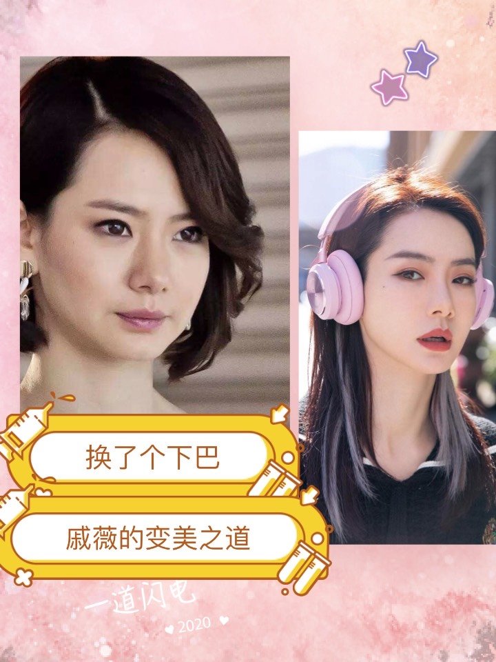 戚薇之前可以说是#下巴后缩#重度患者了,自从换了个_圈子-新氧美容