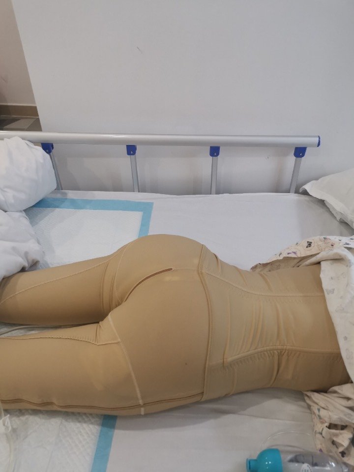 术后第一天,一直趴着还是挺难熬的,好在医院的床很软_圈子-新氧美容