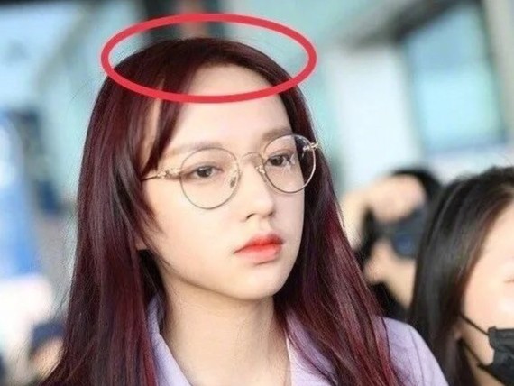回到低颅顶女星这个话题上来,娱乐圈内除了赵小棠,其实颅顶低的还