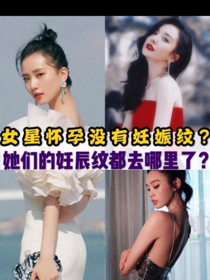 女星怀孕没有妊娠纹?她们的妊辰纹都去哪里了?