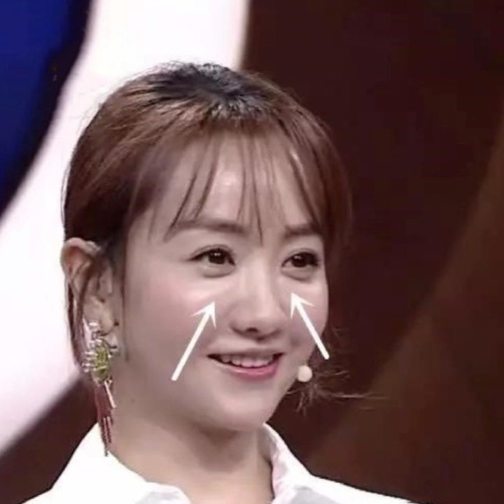 女明星也逃脱不了的显老元凶-眼袋