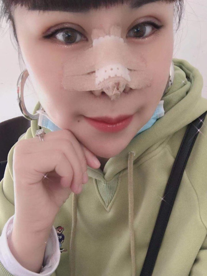 现在就是感觉眼睛暂时比鼻子恢复得要快一些,我纹过美瞳线也没有影响