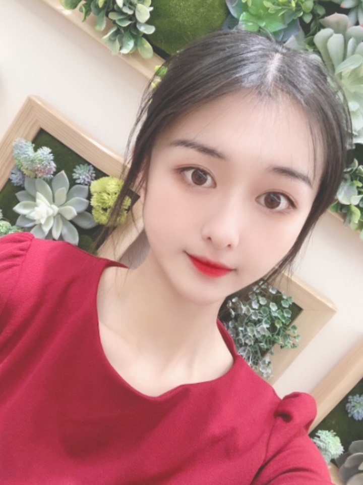 一直以来都想拥有一双迷人的大眼睛,真的是可以给自己_圈子-新氧美容