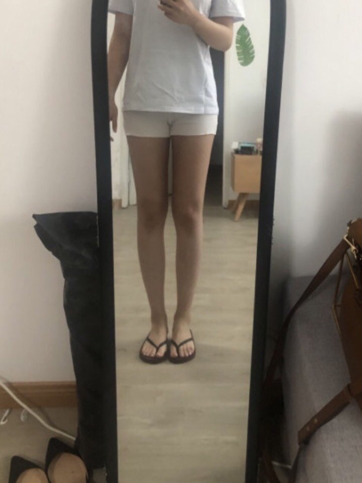 现在做完大腿吸脂后,两条腿之间总算是有缝隙了,整个人特别轻盈,好长