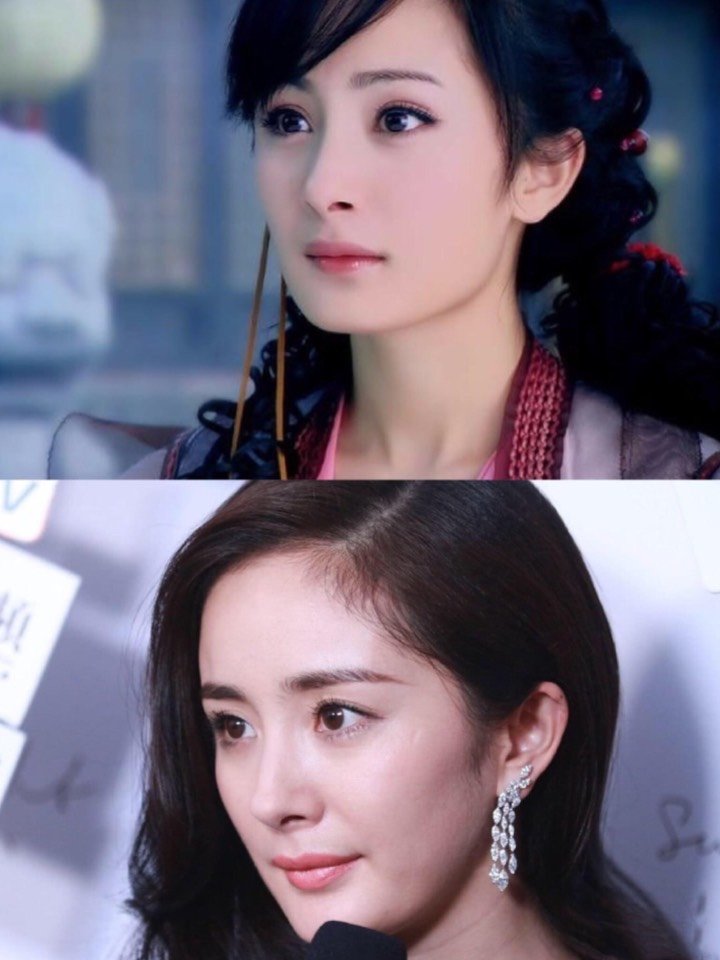 杨幂牙齿内倾的教训告诉你,拔牙并不能瘦脸