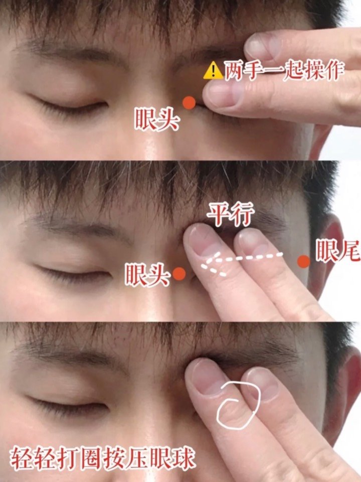 干货内双都没了近视眼敷男士蒸汽眼罩逆袭电眼