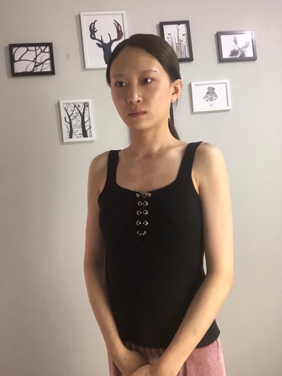 从高中开始就被朋友同学开玩笑说胸小,说发育不良,刚_圈子-新氧美容