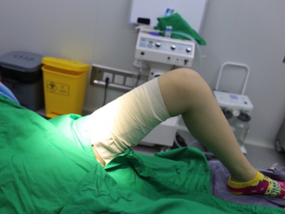 其实吸脂过程中没啥感觉,因为有麻醉的,只是刚进手术室的时候有点紧张