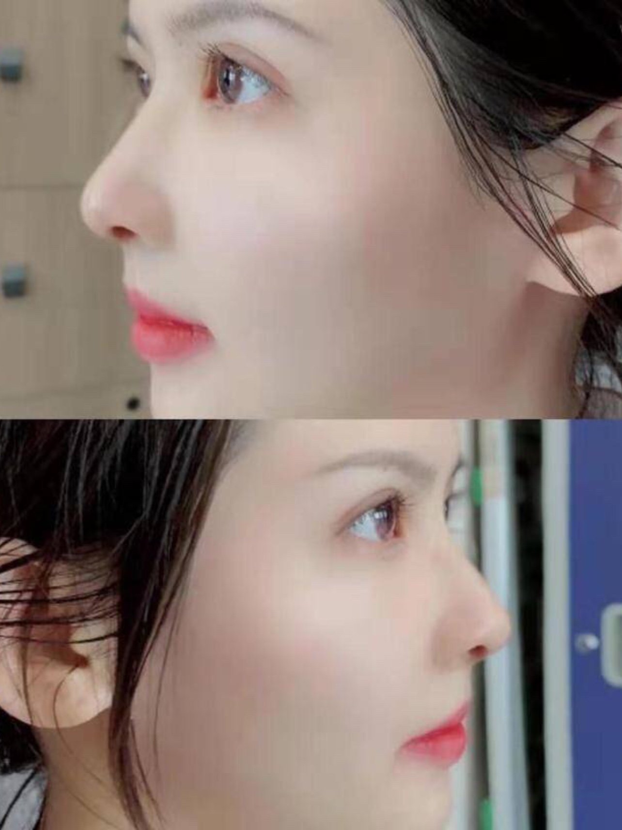 96山根多高好看7191鼻子好看的第一点就是要定好山根起_圈子