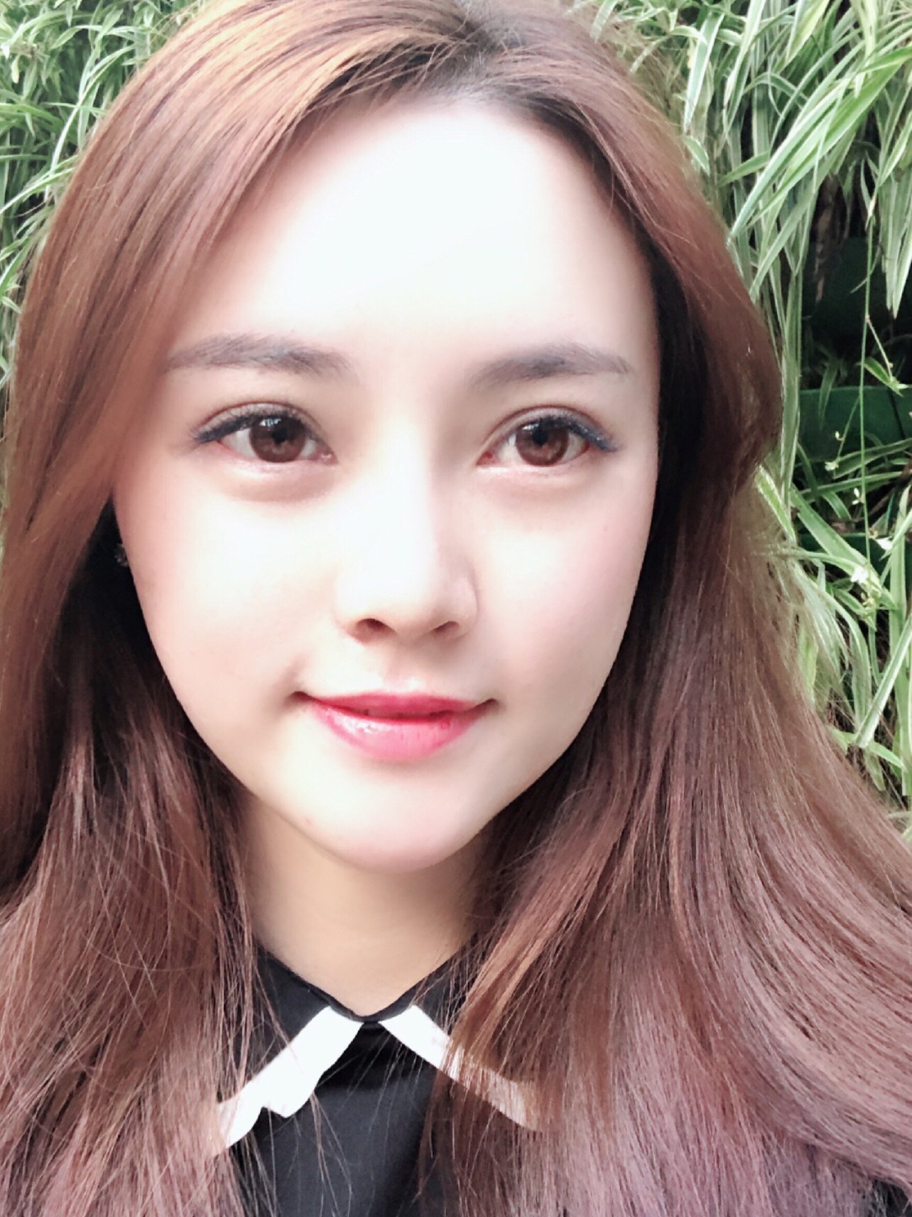 【埋线提升】【6d大v线雕】 脸部线雕 面部提升 线雕小v脸 面部轮廓v