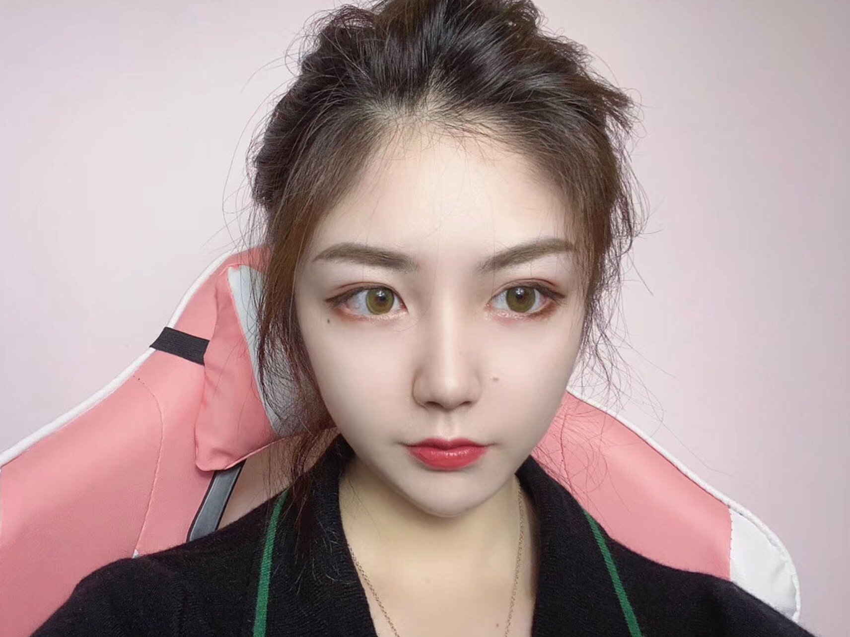 脸大真的很吃亏对于我这种肉肉的大盘子脸来说脂肪过多瘦脸针真的一点