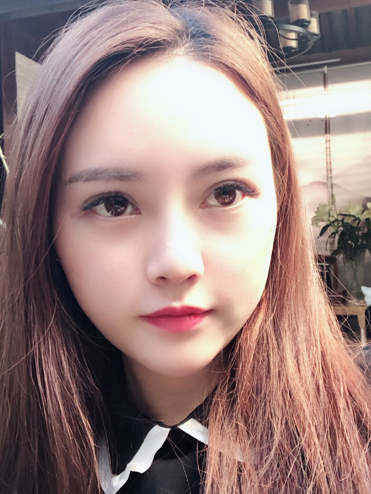 【埋线提升】【6d大v线雕】 脸部线雕 面部提升 线雕小v脸 面部轮廓v