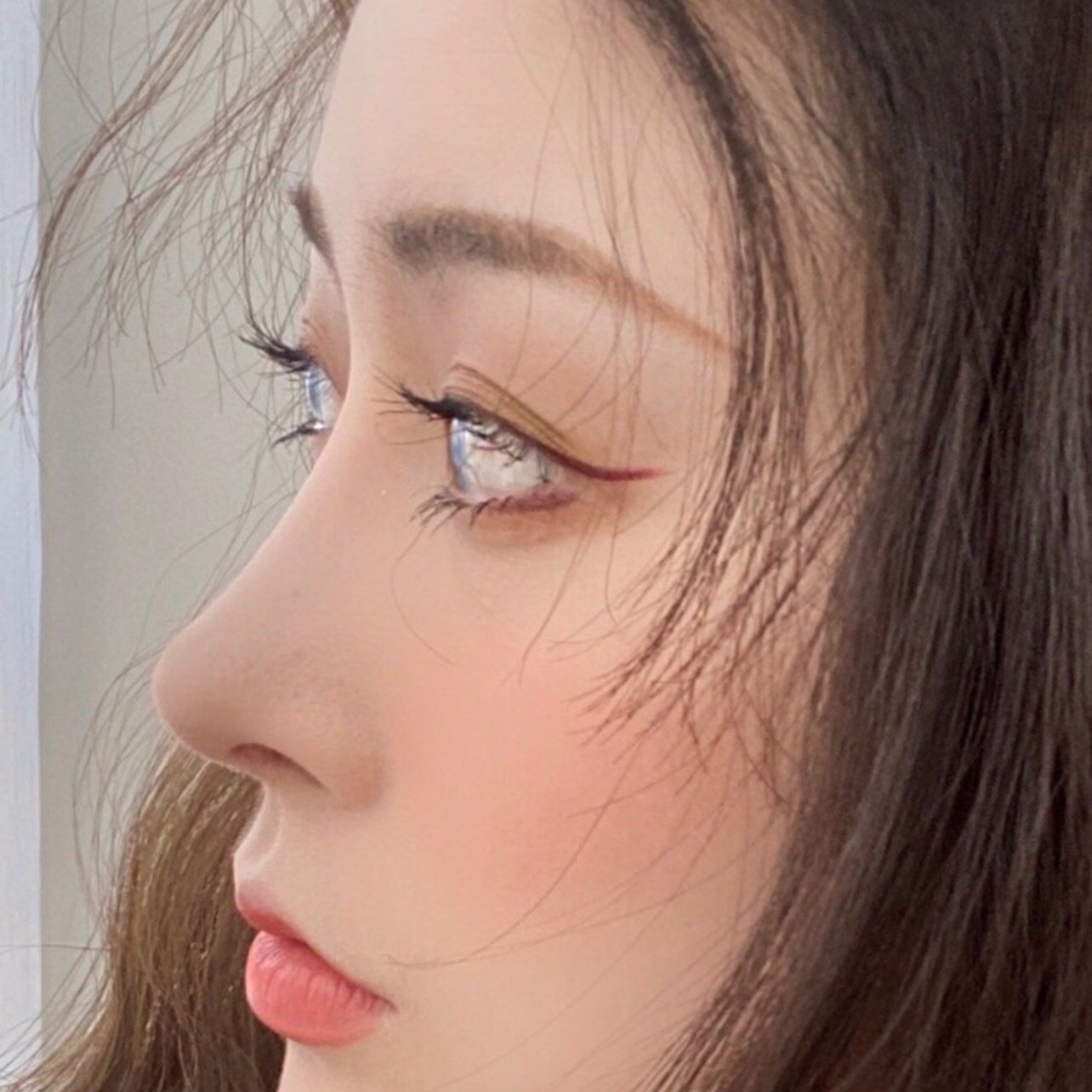 【埋线提升】【6d大v线雕】 脸部线雕 面部提升 线雕小v脸 面部轮廓v